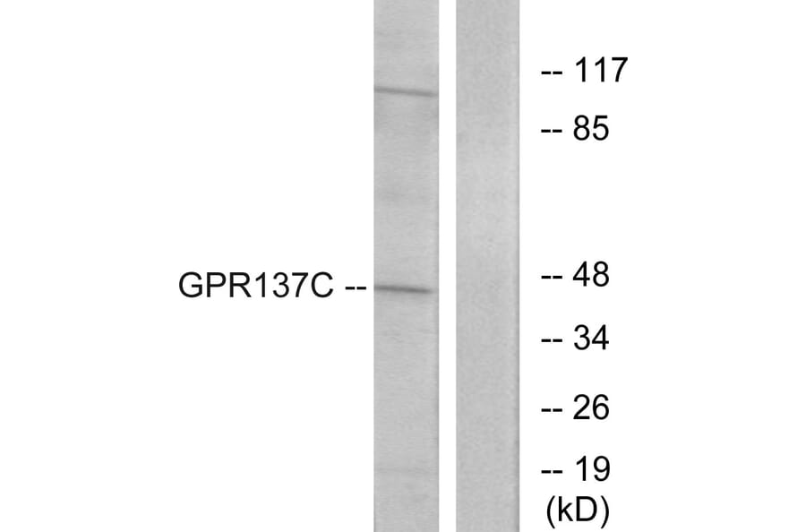 Western Blot - Anti-GPR137C Antibody (G264) - Antibodies.com