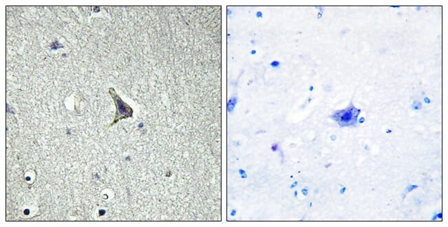 Immunohistochemical analysis of paraffin-embedded human brain tissue using Anti-GPR137C Antibody. The right hand panel represents a negative control, where the antibody was pre-incubated with the immunising peptide.