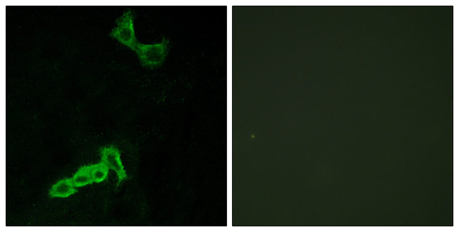 Immunofluorescence analysis of MCF7 cells using Anti-GPR137C Antibody. The right hand panel represents a negative control, where the antibody was pre-incubated with the immunising peptide.