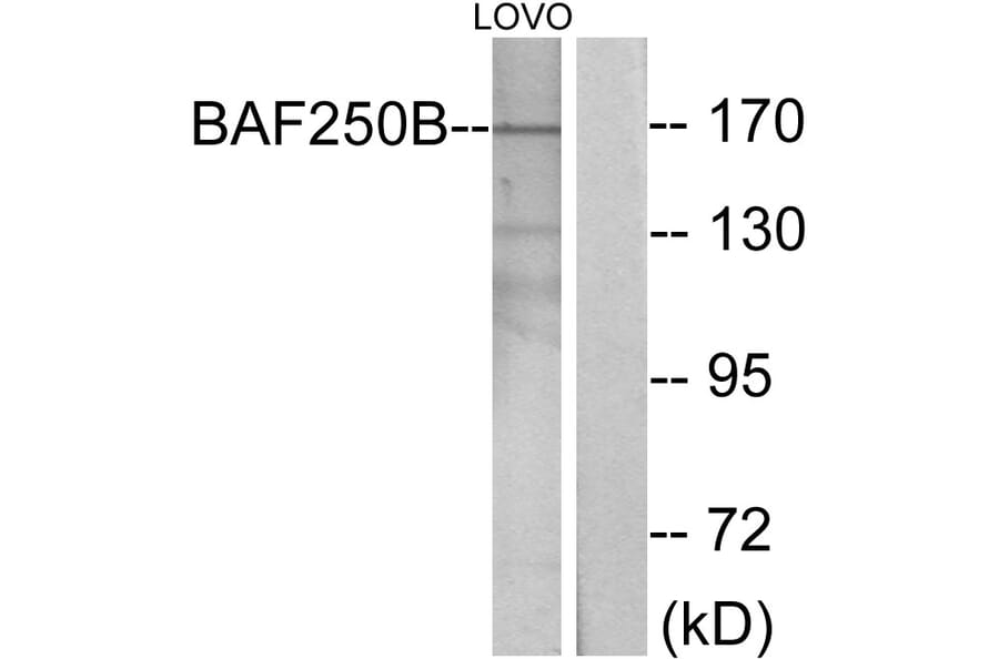Western Blot - Anti-BAF250B Antibody (C11373) - Antibodies.com