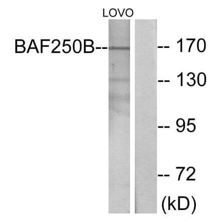 Western Blot - Anti-BAF250B Antibody (C11373) - Antibodies.com