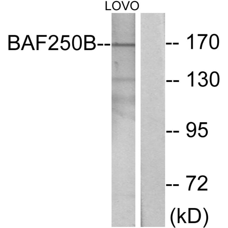 Western Blot - Anti-BAF250B Antibody (C11373) - Antibodies.com