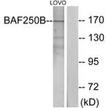 Western Blot - Anti-BAF250B Antibody (C11373) - Antibodies.com