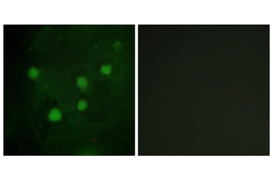 Immunofluorescence - Anti-BAF250B Antibody (C11373) - Antibodies.com
