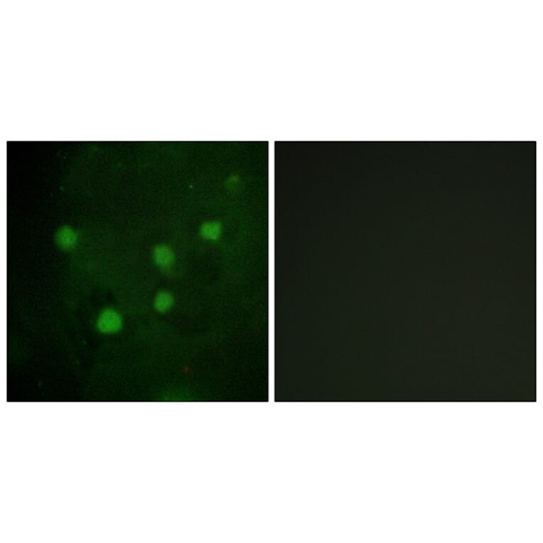 Immunofluorescence - Anti-BAF250B Antibody (C11373) - Antibodies.com