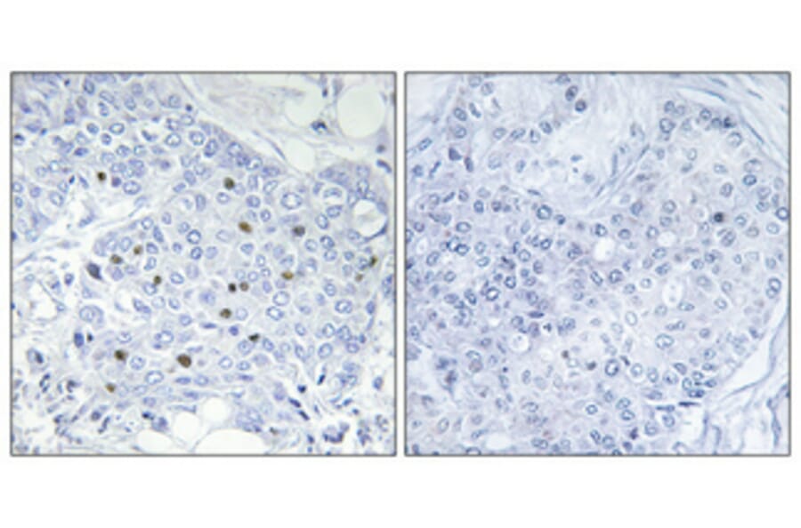 Immunohistochemistry - Anti-BAF250B Antibody (C11373) - Antibodies.com