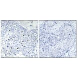 Immunohistochemistry - Anti-BAF250B Antibody (C11373) - Antibodies.com