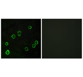 Immunofluorescence - Anti-ADORA2A Antibody (G202) - Antibodies.com