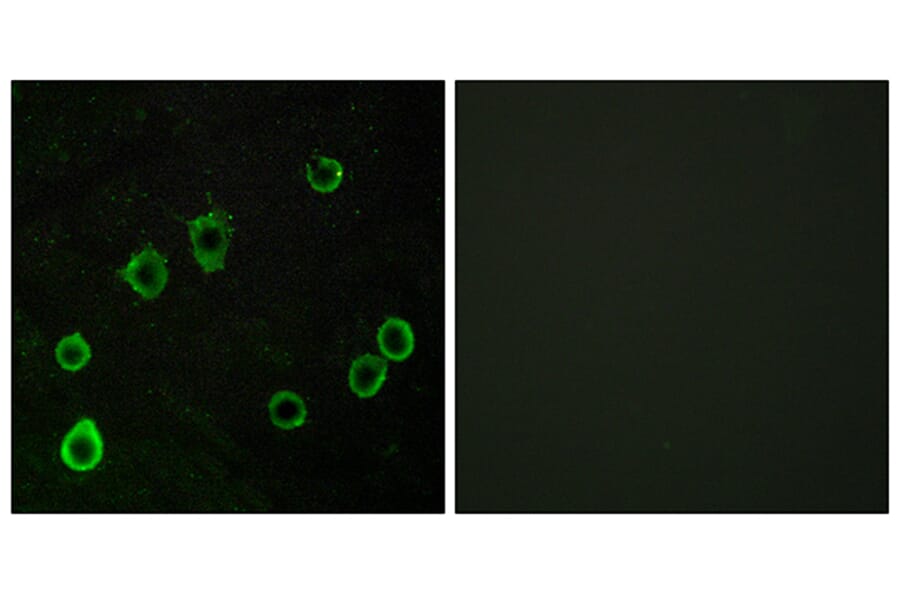 Immunofluorescence - Anti-ADORA2A Antibody (G202) - Antibodies.com