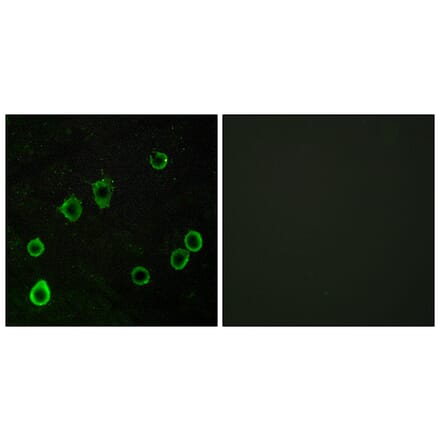 Immunofluorescence - Anti-ADORA2A Antibody (G202) - Antibodies.com