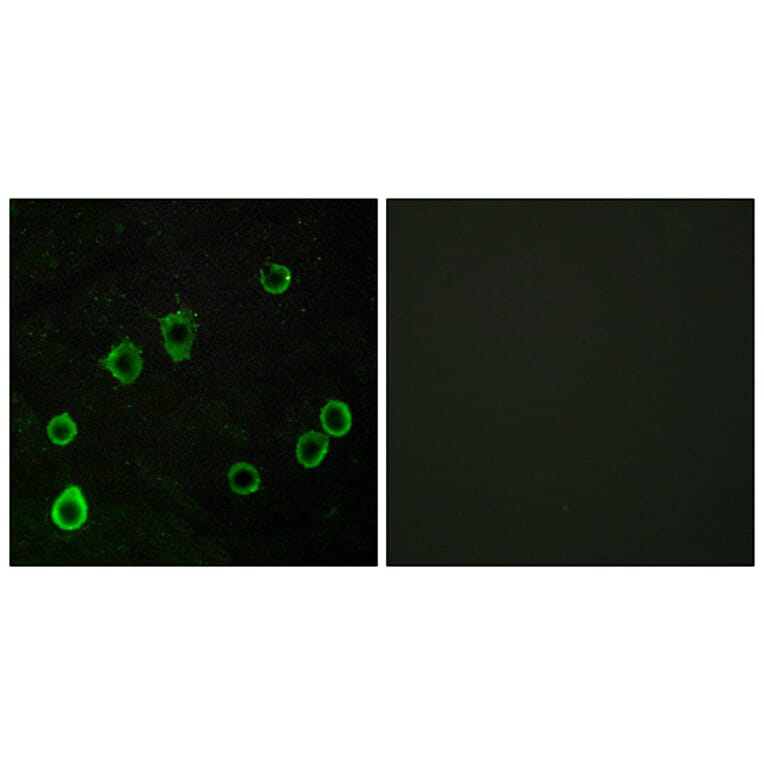 Immunofluorescence - Anti-ADORA2A Antibody (G202) - Antibodies.com
