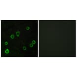 Immunofluorescence - Anti-ADORA2A Antibody (G202) - Antibodies.com