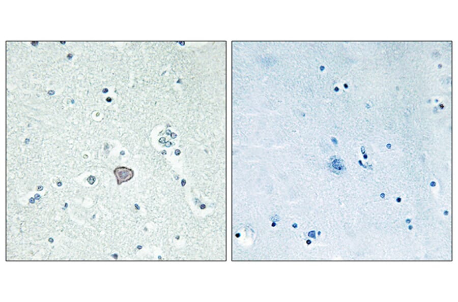Immunohistochemistry - Anti-ADORA2A Antibody (G202) - Antibodies.com
