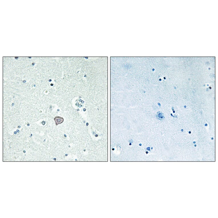 Immunohistochemistry - Anti-ADORA2A Antibody (G202) - Antibodies.com