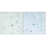 Immunohistochemistry - Anti-ADORA2A Antibody (G202) - Antibodies.com