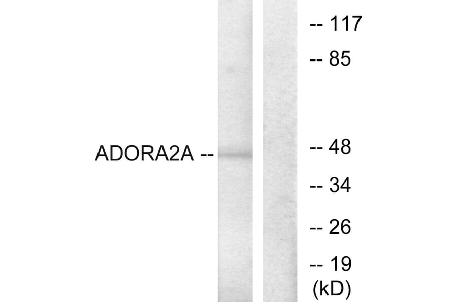 Western Blot - Anti-ADORA2A Antibody (G202) - Antibodies.com