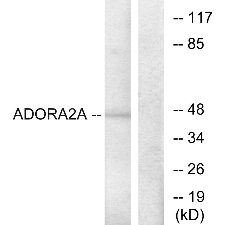 Western Blot - Anti-ADORA2A Antibody (G202) - Antibodies.com