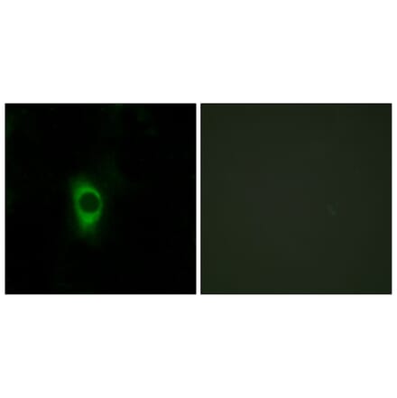 Immunofluorescence - Anti-5-HT-2B Antibody (C12014) - Antibodies.com