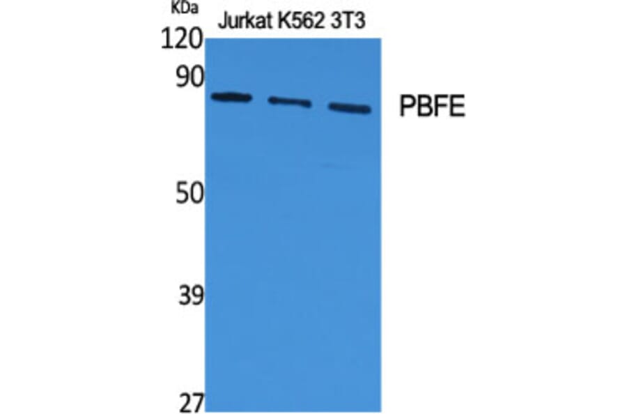 Western Blot - Anti-EHHADH Antibody (C17622) - Antibodies.com