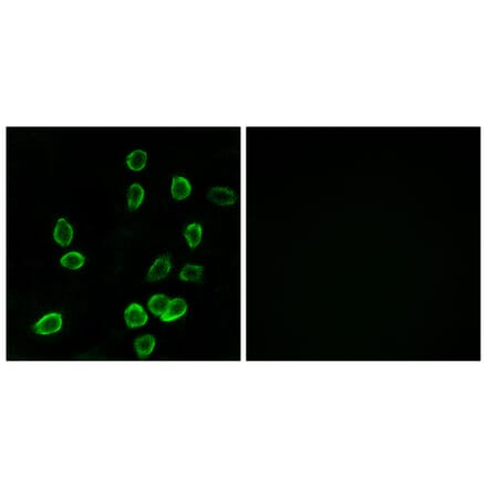 Immunofluorescence - Anti-ATP5G3 Antibody (C14599) - Antibodies.com