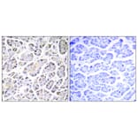 Immunohistochemistry - Anti-ATP5G3 Antibody (C14599) - Antibodies.com