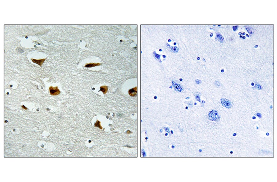 Immunohistochemistry - Anti-4E-BP1 Antibody (B0402) - Antibodies.com