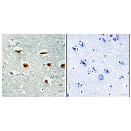 Immunohistochemistry - Anti-4E-BP1 Antibody (B0402) - Antibodies.com