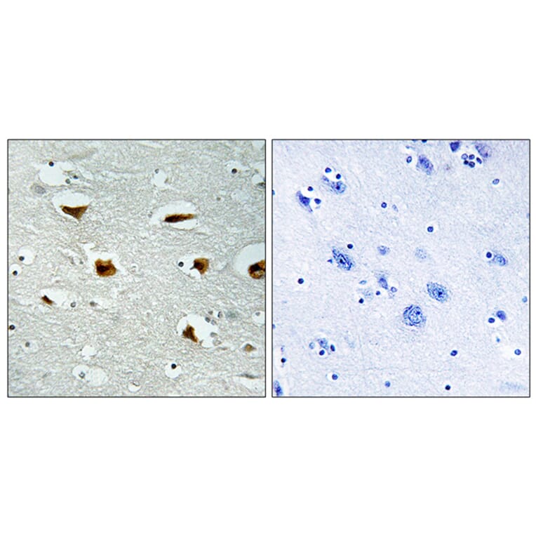 Immunohistochemistry - Anti-4E-BP1 Antibody (B0402) - Antibodies.com