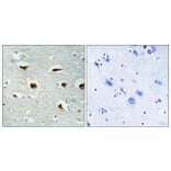 Immunohistochemistry - Anti-4E-BP1 Antibody (B0402) - Antibodies.com