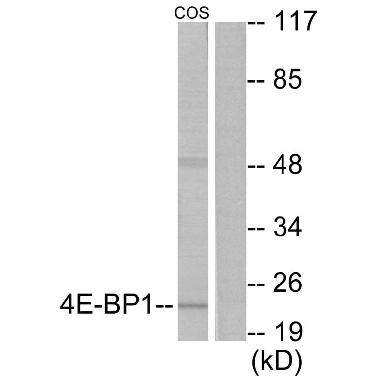 Western Blot - Anti-4E-BP1 Antibody (B0402) - Antibodies.com