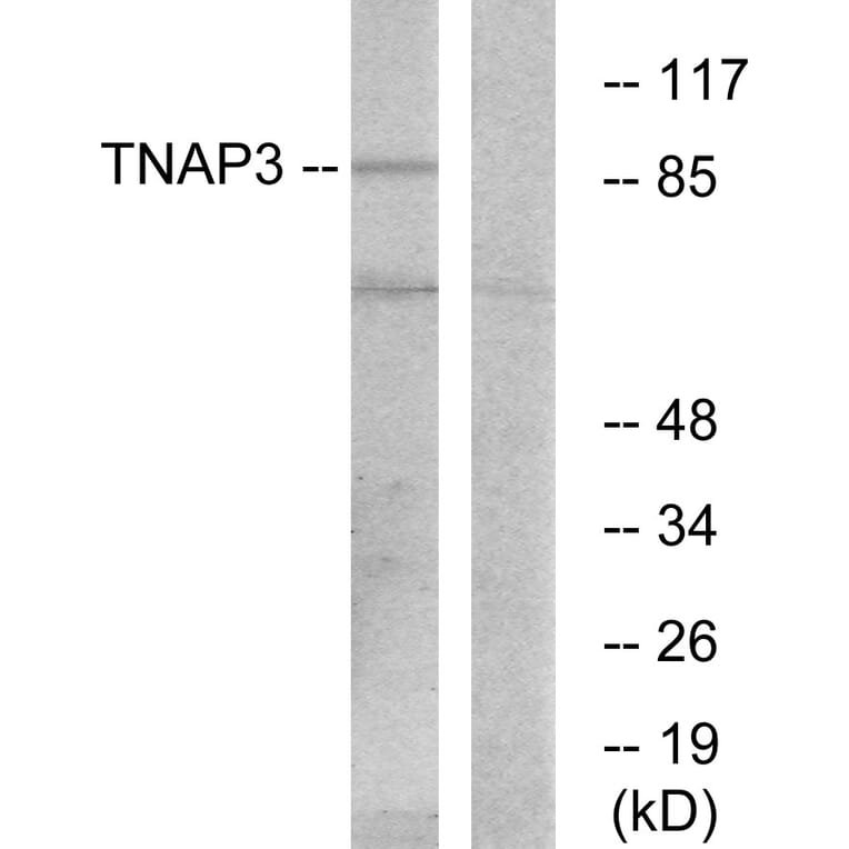 Western Blot - Anti-TNAP3 Antibody (C10444) - Antibodies.com