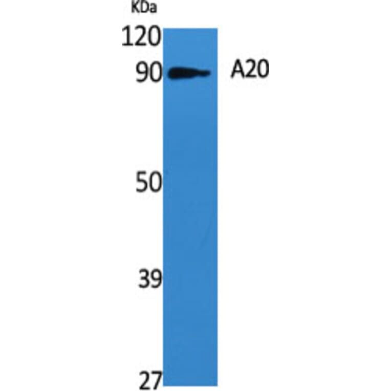 Western Blot - Anti-TNAP3 Antibody (C10444) - Antibodies.com