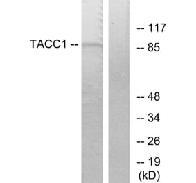 Western Blot - Anti-TACC1 Antibody (C10172) - Antibodies.com