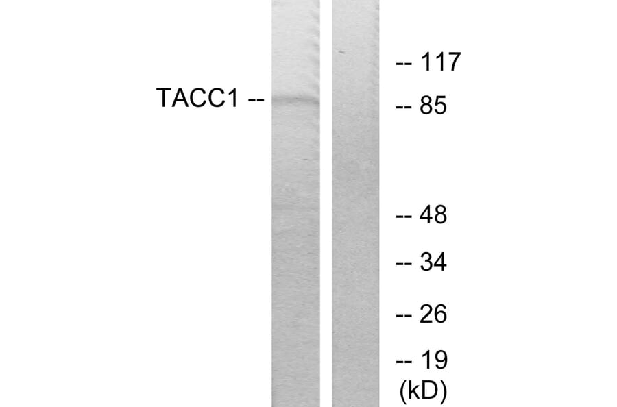 Western Blot - Anti-TACC1 Antibody (C10172) - Antibodies.com