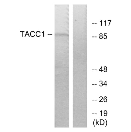 Western Blot - Anti-TACC1 Antibody (C10172) - Antibodies.com