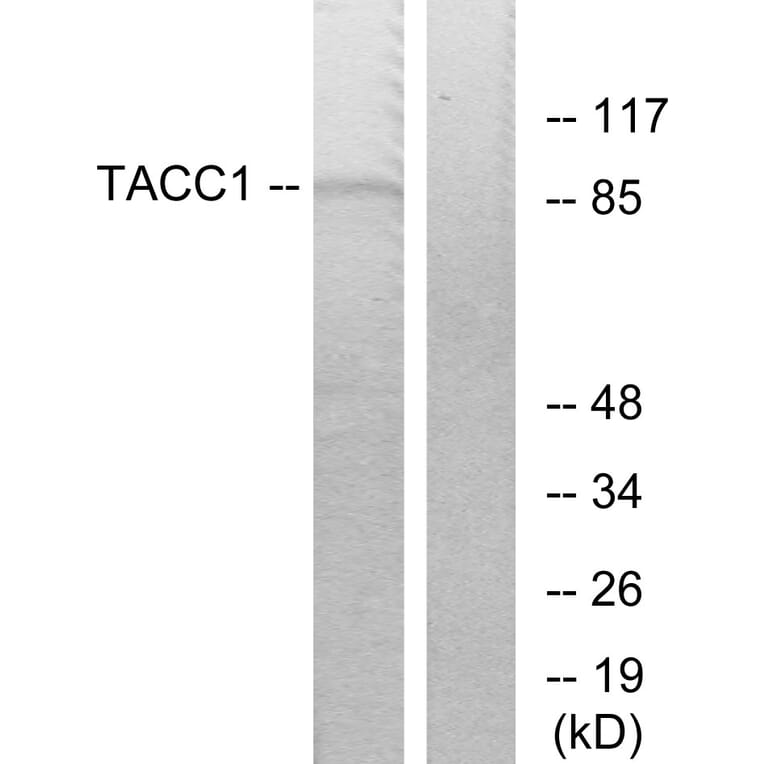 Western Blot - Anti-TACC1 Antibody (C10172) - Antibodies.com