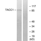 Western Blot - Anti-TACC1 Antibody (C10172) - Antibodies.com