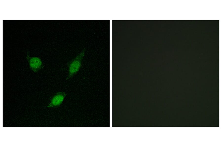 Immunofluorescence - Anti-TACC1 Antibody (C10172) - Antibodies.com