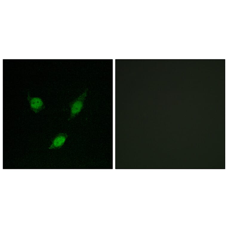 Immunofluorescence - Anti-TACC1 Antibody (C10172) - Antibodies.com