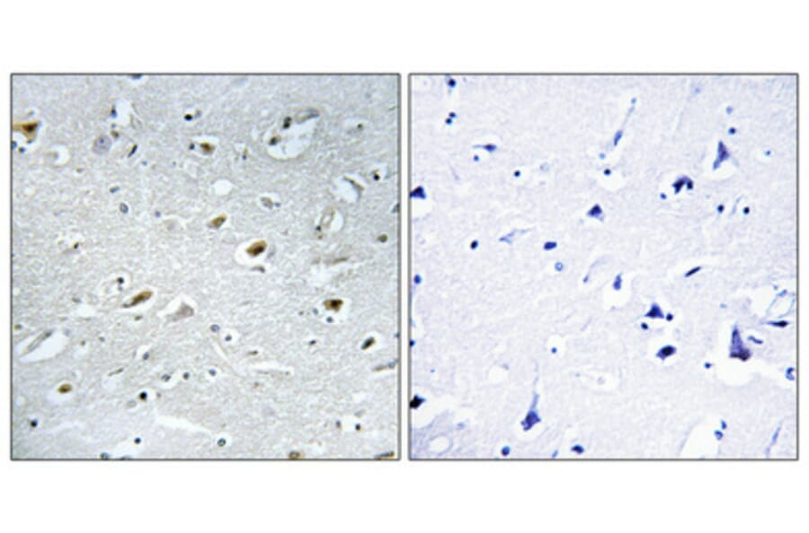 Immunohistochemistry - Anti-TACC1 Antibody (C10172) - Antibodies.com
