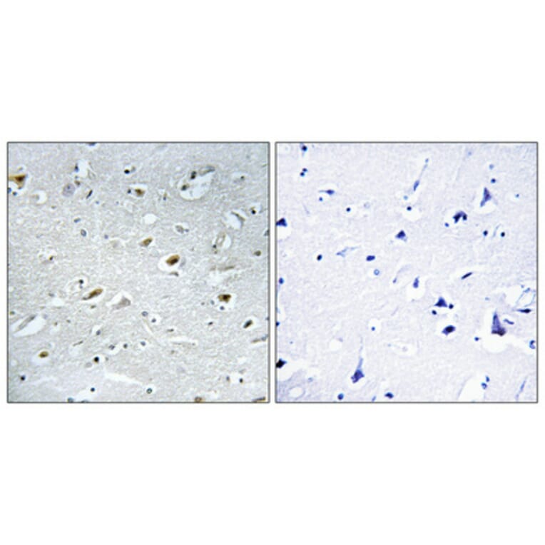 Immunohistochemistry - Anti-TACC1 Antibody (C10172) - Antibodies.com