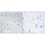 Immunohistochemistry - Anti-TACC1 Antibody (C10172) - Antibodies.com