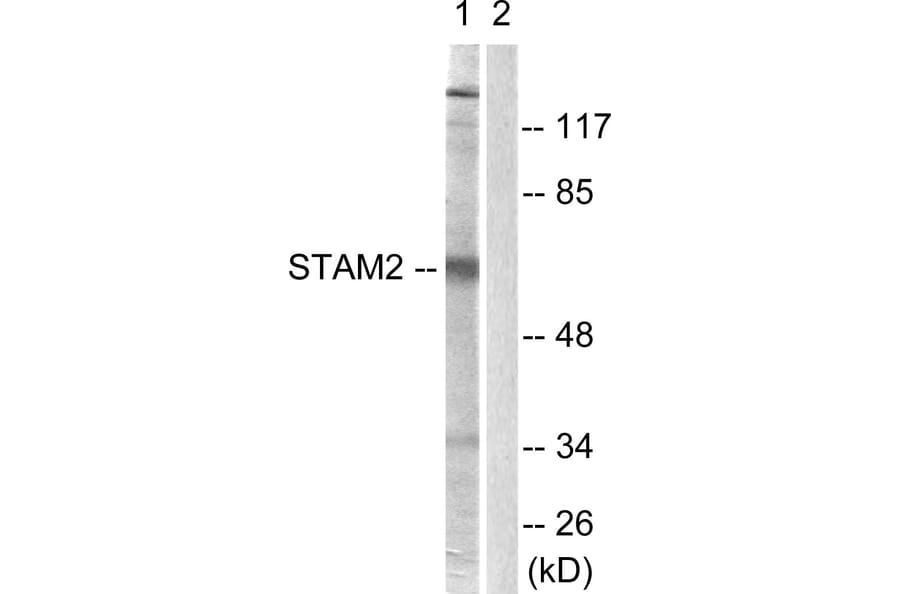 Western Blot - Anti-STAM2 Antibody (B1237) - Antibodies.com