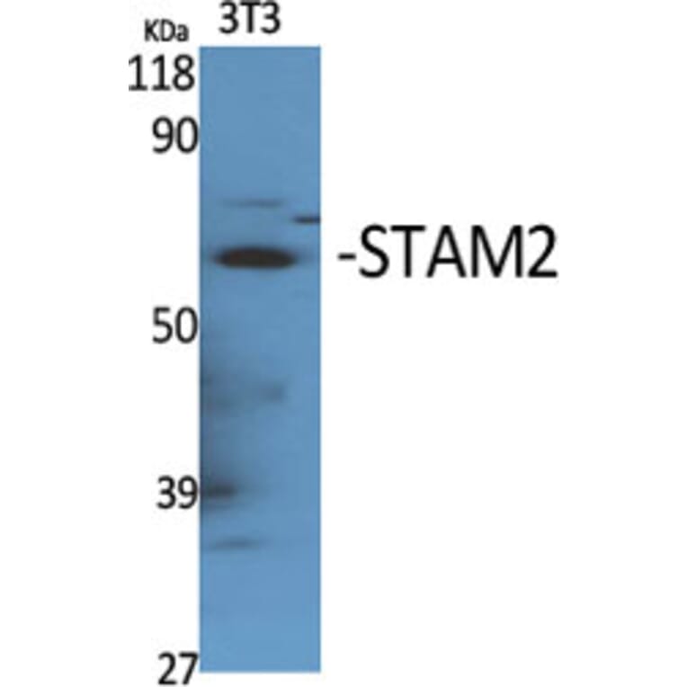 Western Blot - Anti-STAM2 Antibody (B1237) - Antibodies.com