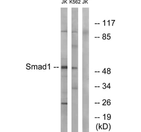 Western Blot - Anti-Smad1 Antibody (B0994) - Antibodies.com