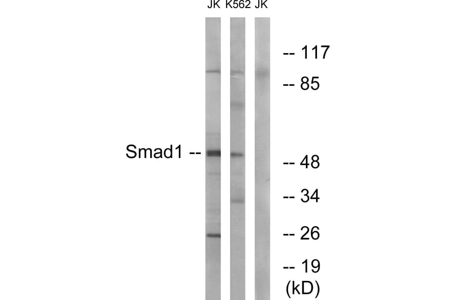 Western Blot - Anti-Smad1 Antibody (B0994) - Antibodies.com