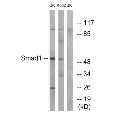 Western Blot - Anti-Smad1 Antibody (B0994) - Antibodies.com