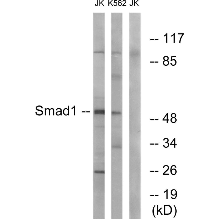 Western Blot - Anti-Smad1 Antibody (B0994) - Antibodies.com