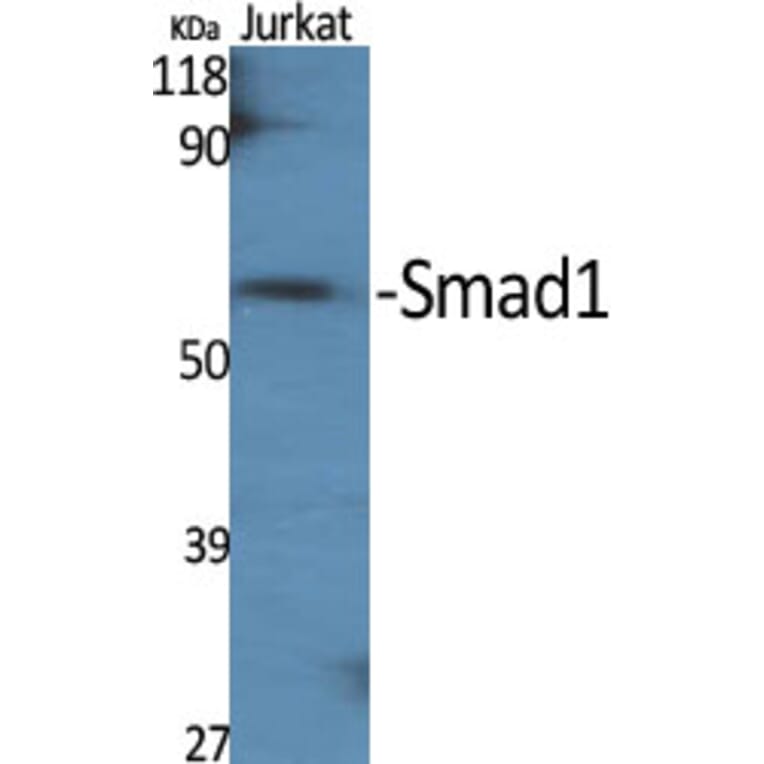 Western Blot - Anti-Smad1 Antibody (B0994) - Antibodies.com