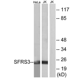 Western Blot - Anti-SFRS3 Antibody (C10809) - Antibodies.com